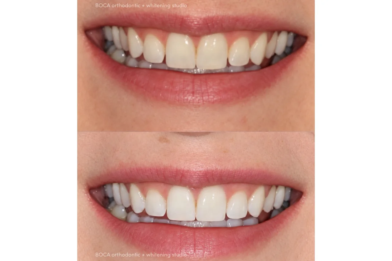 BOCA Orthodontic + Whitening Studio photo 10