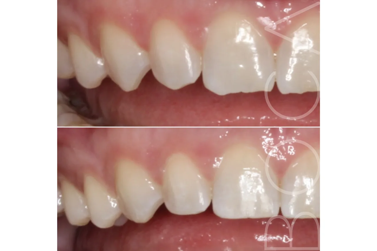 BOCA Orthodontic + Whitening Studio photo 14
