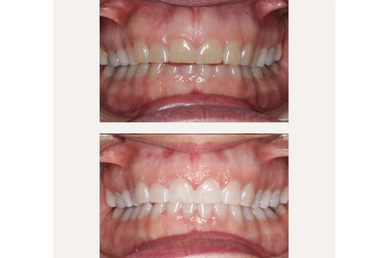 BOCA Orthodontic + Whitening Studio photo 22