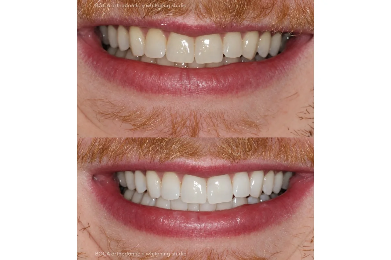 BOCA Orthodontic + Whitening Studio photo 28